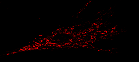 Fibroblast mit gefärbten Mitochondrien.