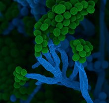 Die Mikrobe des Jahres 2026, Penicillium, ein Pinselschimmel, bildet charakteristische Zellketten mit Sporen am Ende. Rasterelektronenmikroskopische Aufnahme Die Mikrobe des Jahres 2026, Penicillium, ein Pinselschimmel, bildet charakteristische Zellketten mit Sporen am Ende. Rasterelektronenmikroskopische Aufnahme