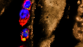 Entzündungshemmende Makrophagen (bunt), die auf Parasiten-Larven „sitzen“.