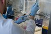 Mensch im Labor am pipettieren