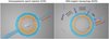 Grafik: Intrazytoplasmatische Spermieninjektion im Mikromaßstab (links) und DNA-Origami-Nanospritze im Nanomaßstab zur gezielten Membrantranslokation (rechts)