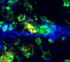 Die Blutgefäße innerhalb einer Leber-Metastase sind blau eingefärbt, T-Zellen grün. Die Blutgefäße innerhalb einer Leber-Metastase sind blau eingefärbt, T-Zellen grün.