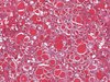 Histologischer Schnitt einer Schilddrüsengewebeprobe aus dem GTEx-Portal. Histologischer Schnitt einer Schilddrüsengewebeprobe