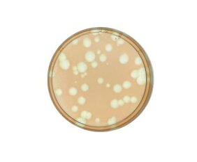 Agarplatte mit marinen Cyanobakterien der Art Synechococcus sp. (rötliche Färbung = Bakterienrasen)