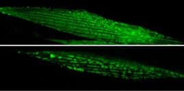 Mitochondrien im gesunden Muskel von C. elegans. 
