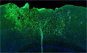 Die fluoreszenzmikroskopische Aufnahme zeigt in unmittelbarer Nähe der Verletzung eine hohe Aktivität des Genregulators NF-kB (grüne Signale). Die fluoreszenzmikroskopische Aufnahme zeigt in unmittelbarer Nähe der Verletzung eine hohe Aktivität des Genregulators NF-kB (grüne Signale).