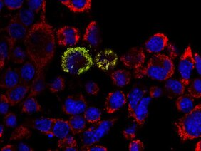 Kultivierte Nervenzellen mit grün angefärbtem Protein HPDL in rot angefärbten Mitochondrien