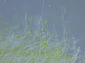 Die Mikroskopaufnahme zeigt die Grünalge Chlamydomonas reinhardtii (grün) und den Pilz Aspergillus nidulans (fadenförmig).