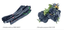 Elektronenmikroskopische Aufnahmen von nicht-axenischen Kulturen zweier Cyanobakterien (Coleofasciculus, Chlorogloea). 