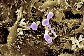 Der Hefepilz Candida albicans (violett eingefärbt) auf Epithelzellen.