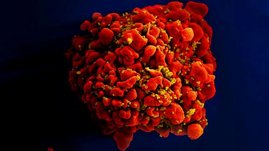   Die rasterelektronenmikroskopische Aufnahme zeigt eine menschliche Immunzelle – auf ihrer Oberfläche haften zahlreiche gelb eingefärbte HIV-1-Viruspartikel