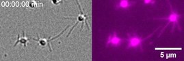  Lokiarchaeen (Archaeen-Gattung) die mit einem fluoreszenten Farbstoff (lila) für Aktin, das interne Zytoskelett, gefärbt sind.