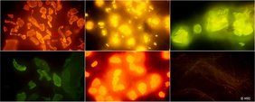Fluoreszenz-Aufnahme mit Mikroplastik 