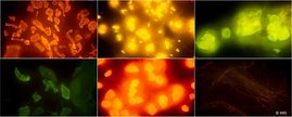 Fluoreszenz-Aufnahme mit Mikroplastik 