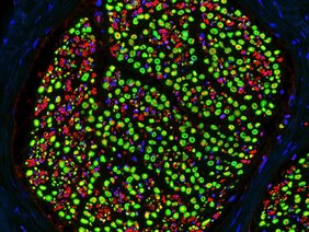 Querschnitt durch einen peripheren Nerv der Maus. Einzelne Axone wurden in rot markiert. Schwann Zellen, die die Axone mit einer fettreichen Isolationsschicht ringförmig ummanteln, sind in grün dargestellt. Die Zellkerne aller Zellen im Nerv sind blau markiert