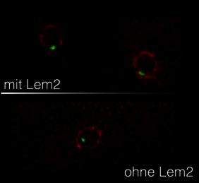  Zellkernmembran und RNA-Moleküle Abbau