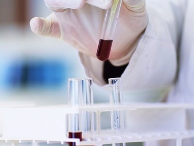Hand beim Pipettieren.