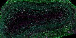 Neu entstandenen Nervenzellen (violett) im Riechkolben des Gehirns eines Muttertiers