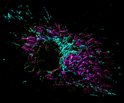 Makrophage mit sich vermehrenden Salmonellen Bakterien