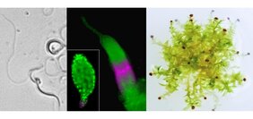 Protein PINC hat einen Einfluss auf die Motilität der Spermien