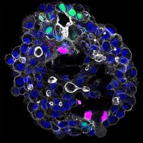 Menschliches periportales Assembloid, dass die drei wichtigsten Zelltypen der Leber zeigt: Portalfibroblasten (magenta), Cholangiozyten (grün) und Hepatozytenkerne (blau). Menschliches periportales Assembloid, dass die drei wichtigsten Zelltypen der Leber zeigt: Portalfibroblasten (magenta), Cholangiozyten (grün) und Hepatozytenkerne (blau).