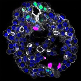 Menschliches periportales Assembloid, dass die drei wichtigsten Zelltypen der Leber zeigt: Portalfibroblasten (magenta), Cholangiozyten (grün) und Hepatozytenkerne (blau).