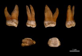 Oberer Backenzahn eines männlichen Neandertalers (Spy 94a) aus Spy, Belgien.