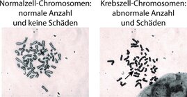 Chromosomen-Fehler in Krebszellen 