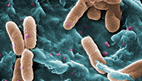 Pseudomonas aeruginosa Krankenhauskeim 