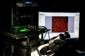 Um Ribosomen in Echtzeit zu beobachten, nutzte das Team Total-Internal-Reflection-Fluoreszenz-Mikroskopie (TIRF)