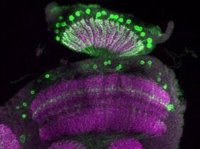 Lichtintensitätssensitive L3-Zellen (grün) im Gehirn der Fliege 