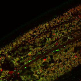Das grün fluoreszierende Signal zeigt die Stabilität der mitochondrialen Oberflächenproteine an (rot markiert).  Das grün fluoreszierende Signal zeigt die Stabilität der mitochondrialen Oberflächenproteine an (rot markiert).