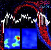 Kcnq3-Immunofluoreszenz im Hippocampus