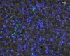 Immunfluoreszenz-Bildgebung der Expression des Platelet-derived growth factor α (PDGFRα) in exokrinen Bereichen von histologischen Pankreas-Schnitten. 