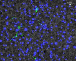 Immunfluoreszenz-Bildgebung der Expression des Platelet-derived growth factor α (PDGFRα) in exokrinen Bereichen von histologischen Pankreas-Schnitten. 
