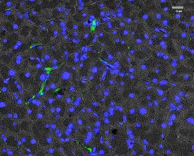Immunfluoreszenz-Bildgebung der Expression des Platelet-derived growth factor α (PDGFRα) in exokrinen Bereichen von histologischen Pankreas-Schnitten. 