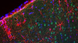 Neuronen (grün) im männlichen Gehirn reagieren auf ein geringeres Insulin Signal