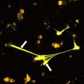 Eosinophile Granulozyten sind in der Lage, DNA-Netze auszuschütten und Mikrofilarien damit einzufangen. Die Fluoreszenzmikroskopieaufnahme zeigt die DNA-Netze 