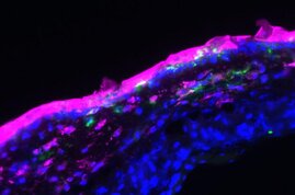 Fluoreszenzmikroskopie: Die Aptamere (hier pink markiert) wurden in Form einer Salbe auf die oberste Hautschicht aufgetragen und drangen auch in tiefere Hautschichten ein (Zellkerne: blau; Antigen-präsentierende Zellen: grün).