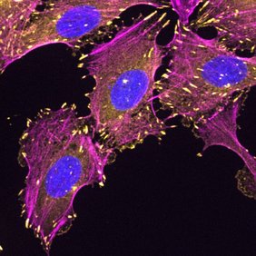 Einblicke in das Innere von Zellen mittels Immunfluoreszenz: Sogenannte U-2 OS Zellen mit angefärbtem Zytoskelett (magenta), fokalen Adhäsionen (gelb) und Zellkernen (blau). Einblicke in das Innere von Zellen mittels Immunfluoreszenz: Sogenannte U-2 OS Zellen mit angefärbtem Zytoskelett (magenta), fokalen Adhäsionen (gelb) und Zellkernen (blau).