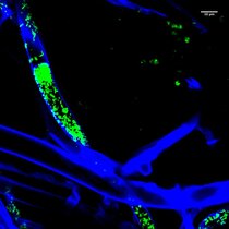 Pilze Symbiose Bakterien