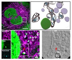 Das Bild zeigt Aufnahmen mit der sogenannten Correlative Light and Electron Microscopy (kurz CLEM) einer Zelle unter mtDNA-Replikationsstress.