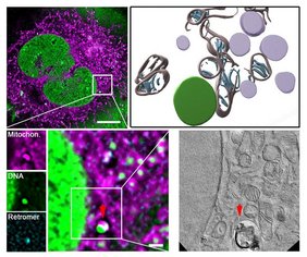 Das Bild zeigt Aufnahmen mit der sogenannten Correlative Light and Electron Microscopy (kurz CLEM) einer Zelle unter mtDNA-Replikationsstress.