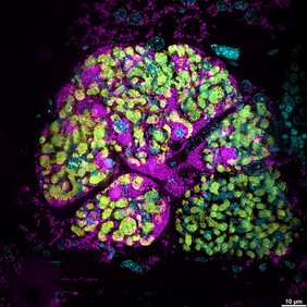 Visualisierung von Bakterien mittels Fluoreszenz-in-situ-Hybridisierung: Zu sehen ist ein mit Sodalis praecaptivus (in Magenta) infiziertes Bakteriom in einem Getreideplattkäfer Oryzaephilus surinamensis der ersten Nachkommengeneration.