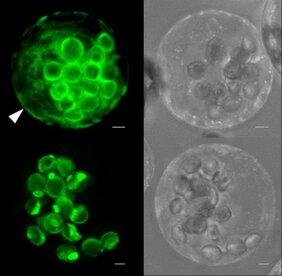  transfizierten Protoplasten (Pflanzenzellen ohne Zellwand) markieren grün fluoreszierende Fusionsproteine des Membranproteins GPT1 (GPT1-GFP, oben) sowohl Plastiden als auch das Endoplasmatische Retikulum (weißer Pfeil). Bei GPT2 (GPT2-GFP, unten) ist das nicht