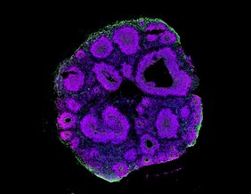 Ein Hirnorganoid (Mensch) besteht aus einer dreidimensionalen Struktur unterschiedlicher Hirnzellen. Magenta, Vorläuferzellen; grün, Neurone; lila, Zellkerne. 