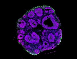 Ein Hirnorganoid (Mensch) besteht aus einer dreidimensionalen Struktur unterschiedlicher Hirnzellen. Magenta, Vorläuferzellen; grün, Neurone; lila, Zellkerne. Ein Hirnorganoid (Mensch) besteht aus einer dreidimensionalen Struktur unterschiedlicher Hirnzellen. Magenta, Vorläuferzellen; grün, Neurone; lila, Zellkerne.