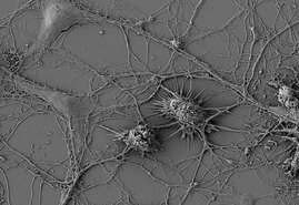 Mikroglia nutzen „tunneling nanotubes“ (TNTs), um direkte Verbindungen zu Neuronen herzustellen 