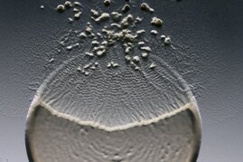  So sieht es aus, wenn ein Bakterium Beute macht.