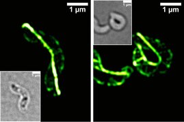 Hochauflösende Fluoreszenzmikroskopie (3D-SIM) und Durchlichtaufnahmen der Zellform 